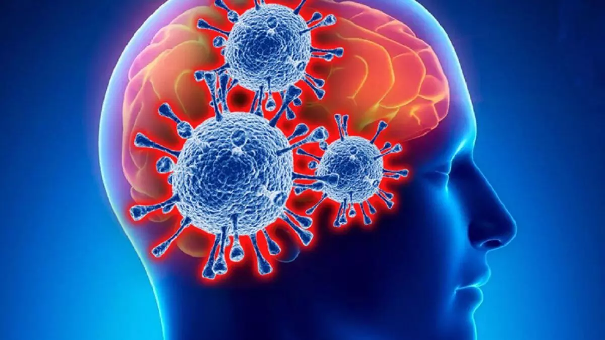 Best neurology treatment in Narhe at Silver Birch Multispeciality Hospital